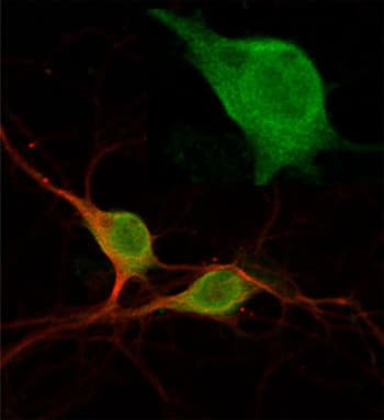 Rab5 Antibody Early Endosome Marker Ab13253  Immunocytochemistry Immunofluorescence Img45710