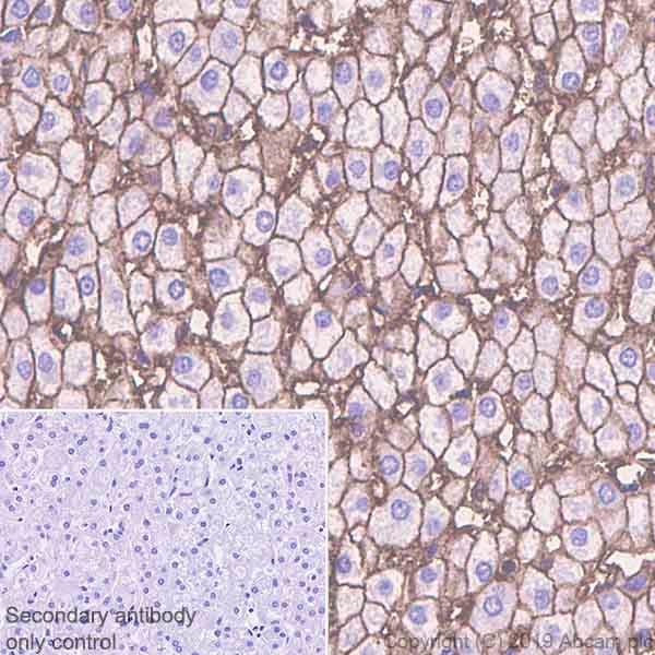 Anti-Glucose Transporter GLUT2 antibody [EPR22946-74](AB234440)
