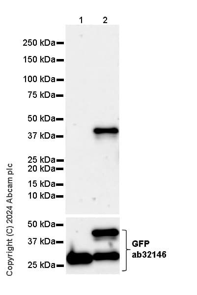 Cholera Enterotoxin Subunit B Antibody Epr27372 4 Ab317738  Western Blot Img432056