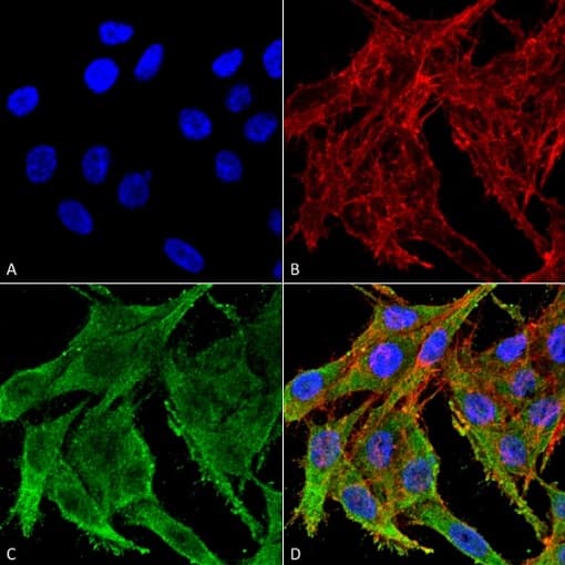 Anti-Kir4.1/KCNJ10 antibody(AB240876)