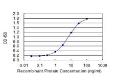 Anti-Activin Receptor Type IIB/ACVR2B antibody [1C11](AB76940)