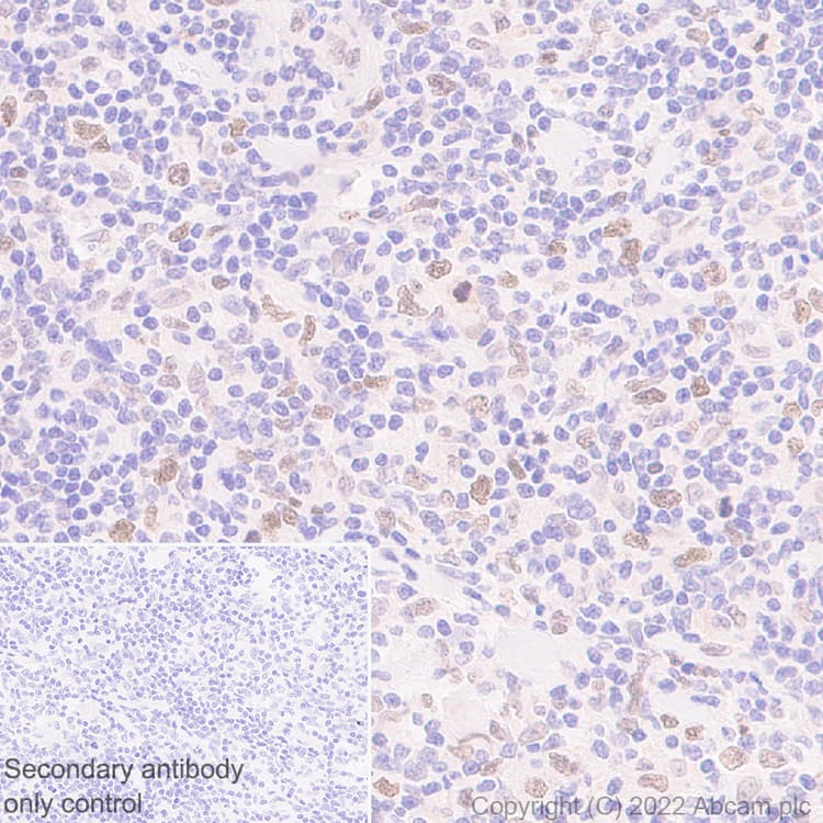 Anti-SUZ12 antibody [EPR26230-82] - BSA and Azide free(AB307892)
