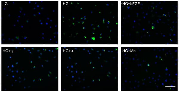 Anti-Cleaved Caspase-3 antibody [E83-77](AB32042)