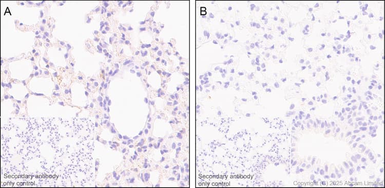 Anti-NG2 antibody [EPR23752-147] - BSA and Azide free(AB275041)