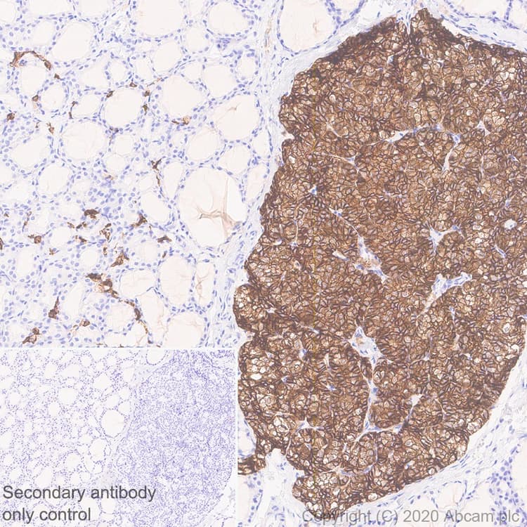 Casr Antibody Epr24050 59 Bsa And Azide Free Ab280360  Immunohistochemistry Formalin Pfa Fixed Paraffin Embedded Sections Img122421