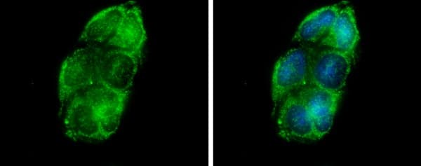 Glycerol Kinase Antibody Ab228615  Immunocytochemistry Immunofluorescence Img130458