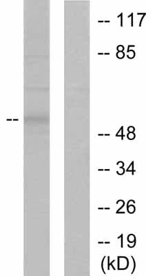 Mmp8 Antibody Ab53017  Western Blot Img145790