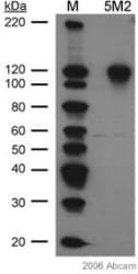 Anti-HIF-1 alpha antibody [H1alpha67](AB1)