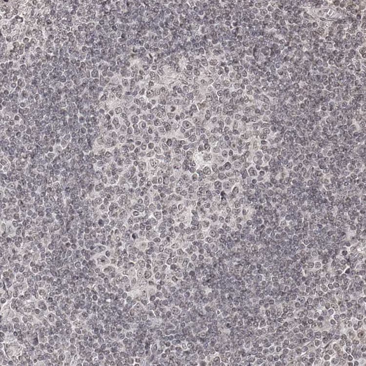 Znf503 Antibody Ab254715  Immunohistochemistry Formalin Pfa Fixed Paraffin Embedded Sections Img18498