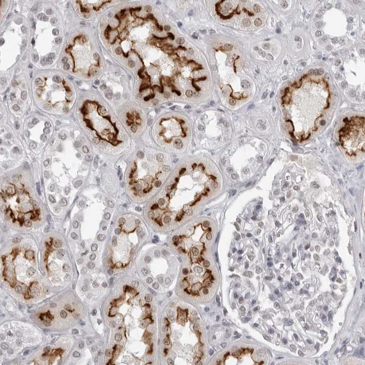 Espin Antibody Ab254774  Immunohistochemistry Formalin Pfa Fixed Paraffin Embedded Sections Img20602