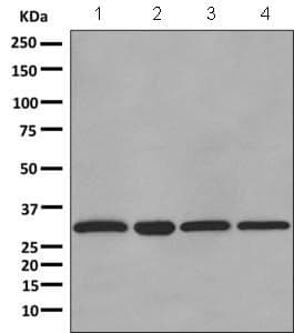 Anti-ATP6V1D antibody [EPR11326(B)](AB157458)