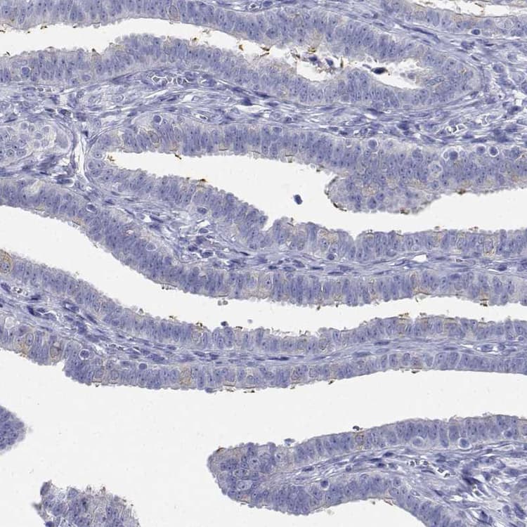 Flj23834 Antibody Ab121337  Immunohistochemistry Formalin Pfa Fixed Paraffin Embedded Sections Img5414