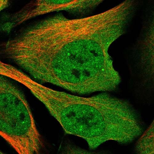 Anti-YTHDC1 antibody(AB122340)