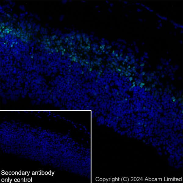 Anti-TBR2 / Eomes antibody [RM2055](AB319166)