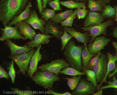 Anti-TIMP3 antibody(AB39184)