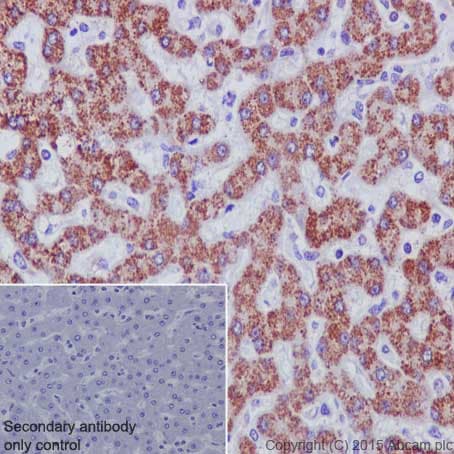 Anti-MMP3 antibody [EP1186Y](AB52915)