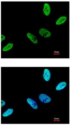 C9orf78 Antibody Ab97644  Immunocytochemistry Immunofluorescence Img9828