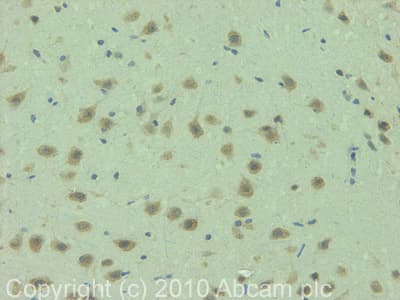 Anti-TRPM2 antibody(AB11168)