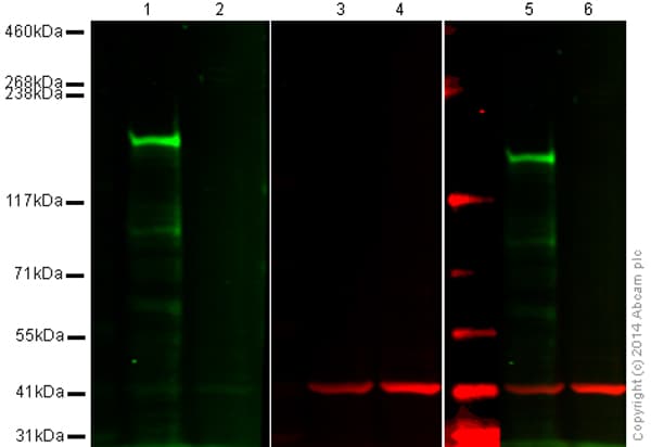 Hdac6 Antibody Epr16982 Ab133493  Western Blot Img139785