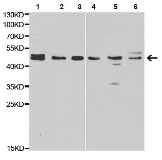 Thyroid Hormone Receptor Beta Antibody N Terminal Ab196484  Western Blot Img123752