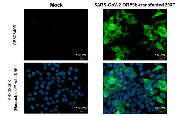 Anti-SARS CoV 2 (COVID 19) ORF9b antibody [HL1918](ab308403)
