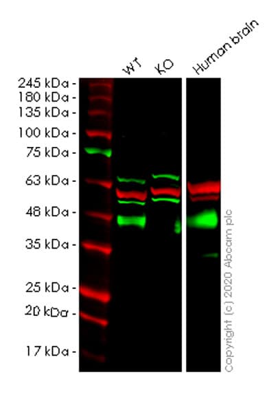 Anti-Synaptophysin antibody [YE269](ab32127)
