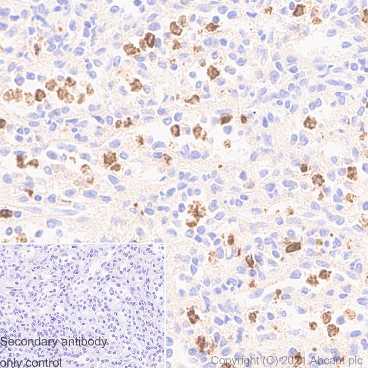 Anti-MMP9 antibody [RM1020](AB283575)
