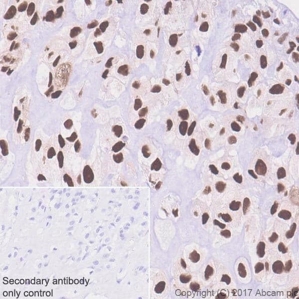 Anti-Sp7 / Osterix antibody [EPR21034] - BSA and Azide free(ab227820)