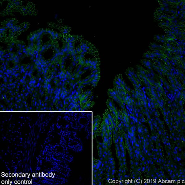 Anti-beta 2 Adrenergic Receptor antibody [EPR707(N)](AB182136)