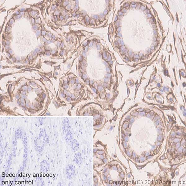 Anti-CD44 antibody [EPR18668](AB189524)