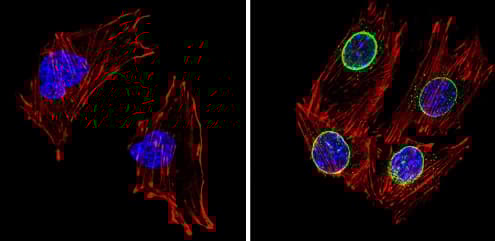 Anti-LXR beta/NER antibody(AB28479)