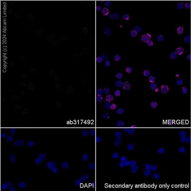 Anti-BRN3A + BRN3B + BRN3C antibody [EPR26313-54](AB317492)