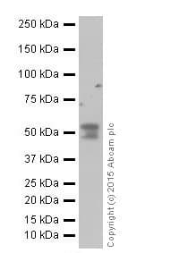 Anti-alpha 1 Antitrypsin antibody [EPR17087-50](AB207303)