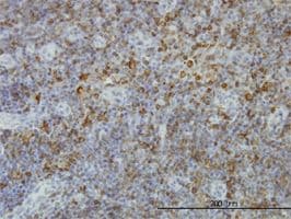 Anti-MHC Class II antibody [6C6](AB55152)