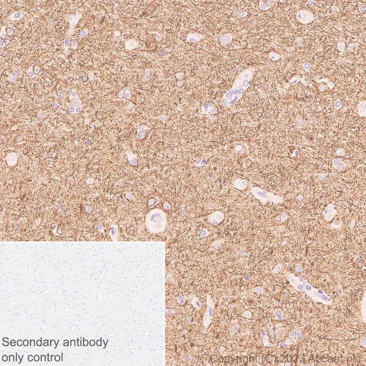 68kda Neurofilament Nf L C Term Antibody Epr28784 63 Bsa And Azide Free Ab315815  Immunohistochemistry Formalin Pfa Fixed Paraffin Embedded Sections Img425442
