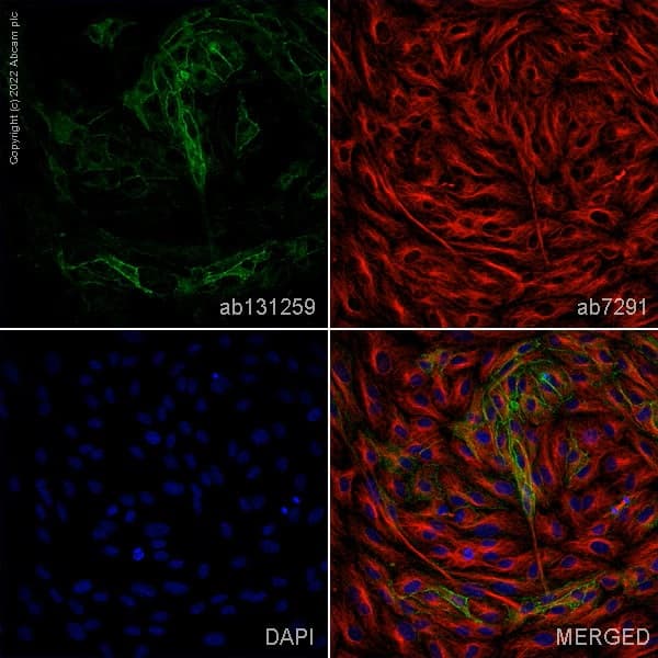 Anti-Claudin 5 antibody [EPR7583](AB131259)