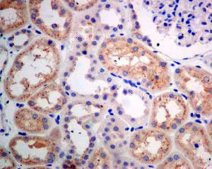 Anti-GBA antibody [EPR5143(3)] - BSA and Azide free(AB215260)