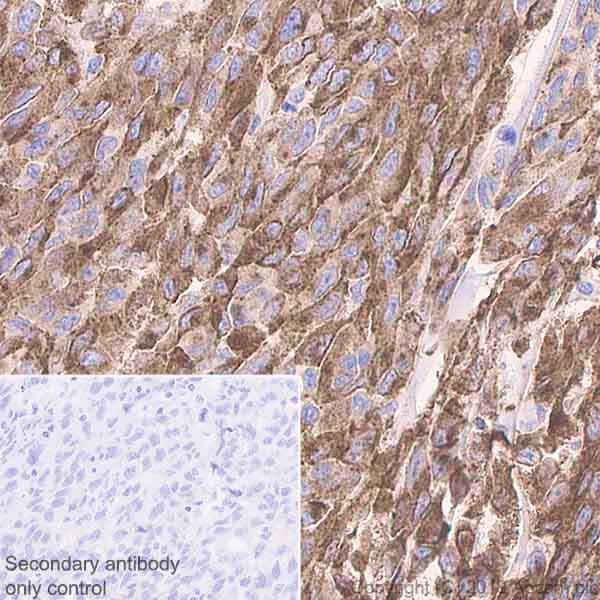 Anti-TRP1 antibody [EPR21960](AB235447)