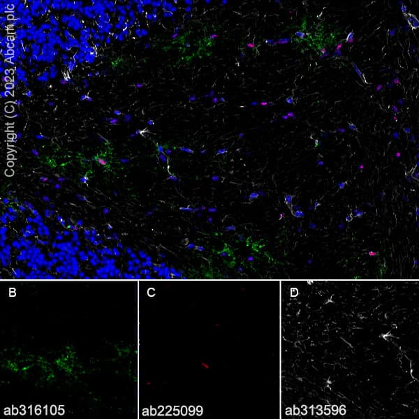 Anti-GPCR GPR17 antibody [EPR26423-34](AB316105)