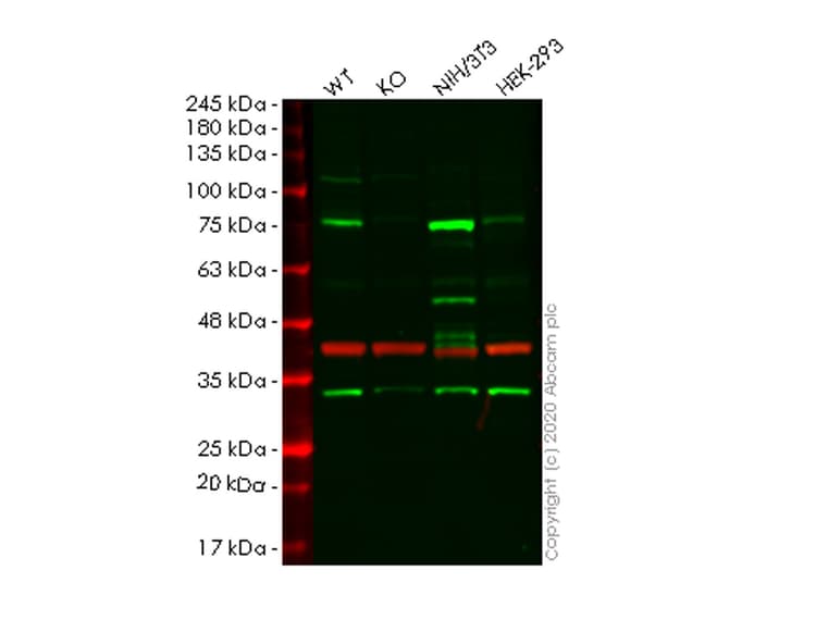 Human CALD1 (Caldesmon/CDM) knockout HeLa cell line(AB265026)
