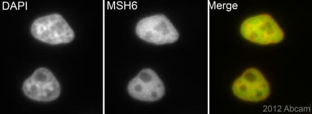 Anti-MSH6 antibody [EPR3945](AB92471)