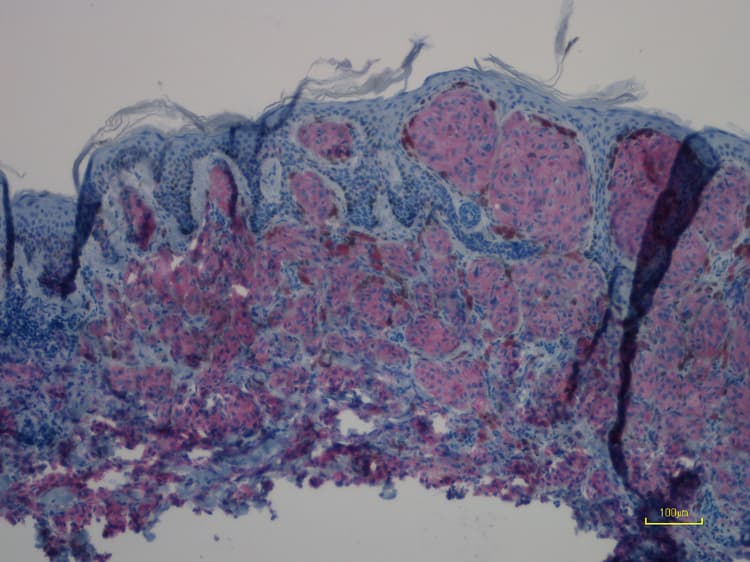 Anti-Ras (mutated Q61R) antibody [SP174](AB227658)