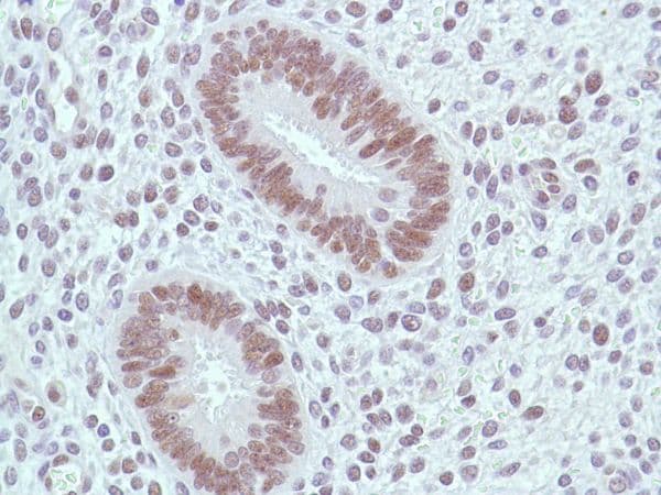 Anti-MSH2 antibody [SP46](AB231437)