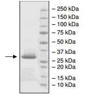 Recombinant Sortase A protein (His tag)(AB198443)