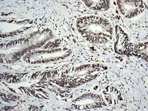 Anti-HIF-1 alpha antibody [EP1215Y](ab51608)