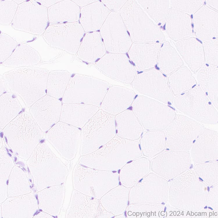 Anti-Slc25a1 antibody [EPR29193-92](AB318201)