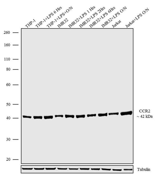 Anti-CCR2 Antibody [RP23040162](AB313463)