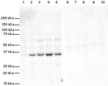 Anti-VDAC1/Porin + VDAC2 + VDAC3 antibody – Mitochondrial Loading Control(AB15895)
