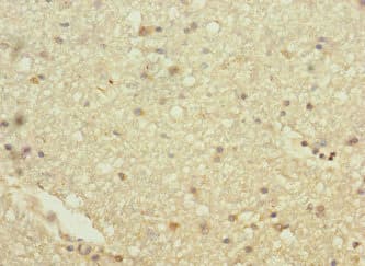 Anti-Hhip antibody(AB230271)