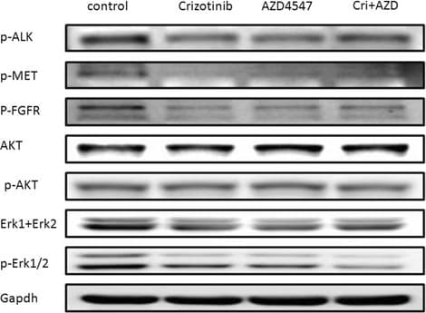 Anti-ErbB2 / HER2 antibody [EP1045Y](AB134182)